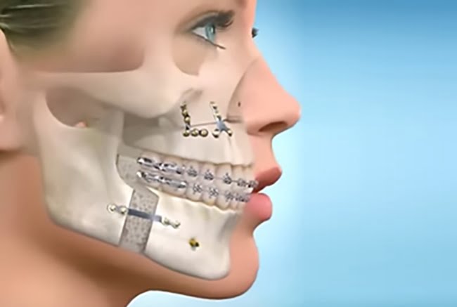 Avanços e Desafios na Cirurgia Maxilofacial Moderna